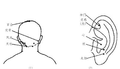 眩晕的按摩疗法