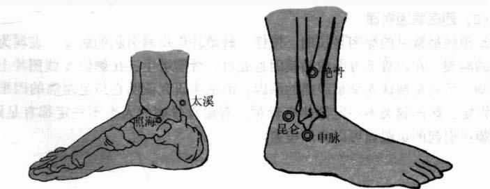 足跟痛钩针疗法