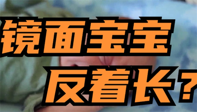 女子诞下百万分之一镜面宝宝 什么是镜面宝宝?