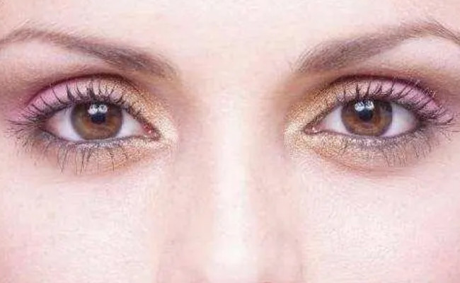 女子左眼瞳孔变大2倍找不到病因 可能的因素有哪些?