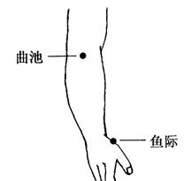 肺炎的拔罐疗法[图]