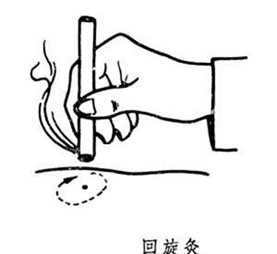 回旋灸