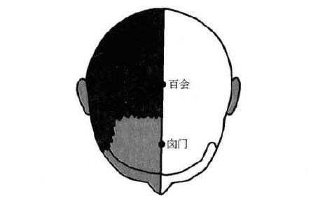 眩晕的药物贴敷疗法